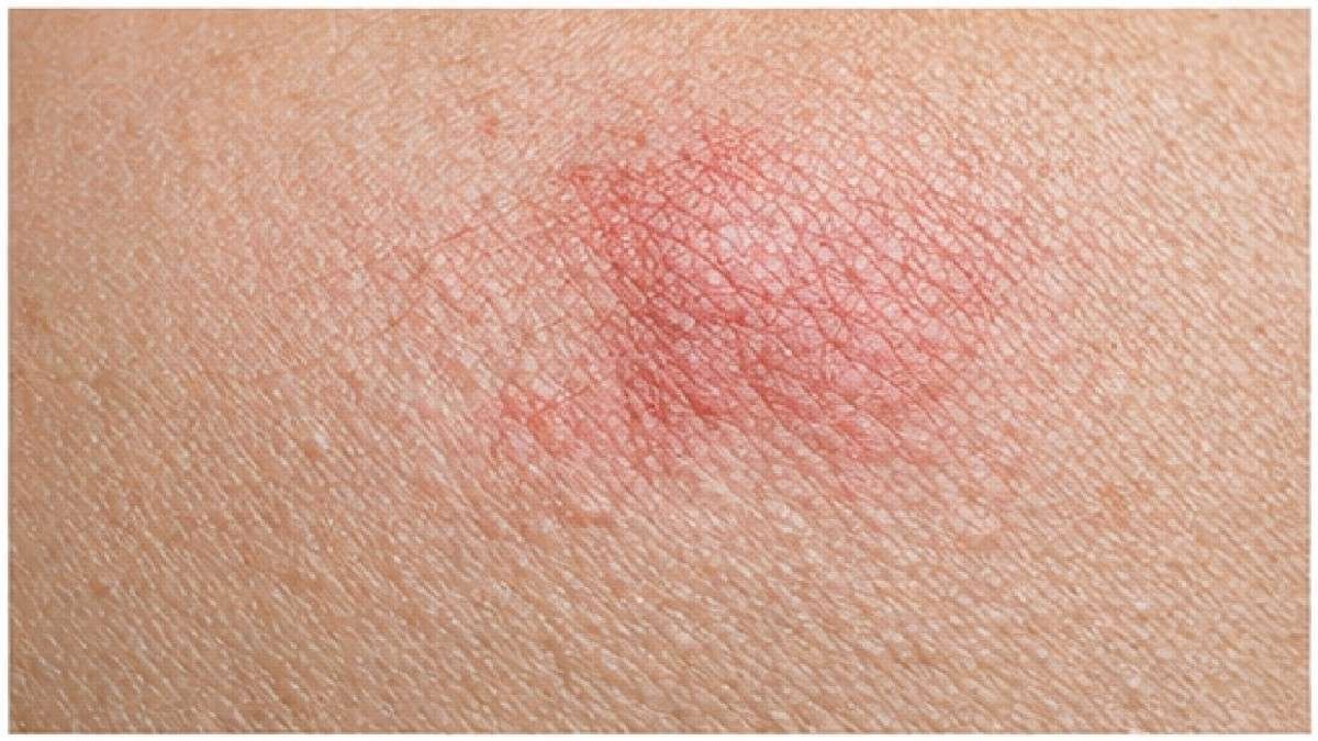 Close up view of dog skin showing mild redness during grooming check